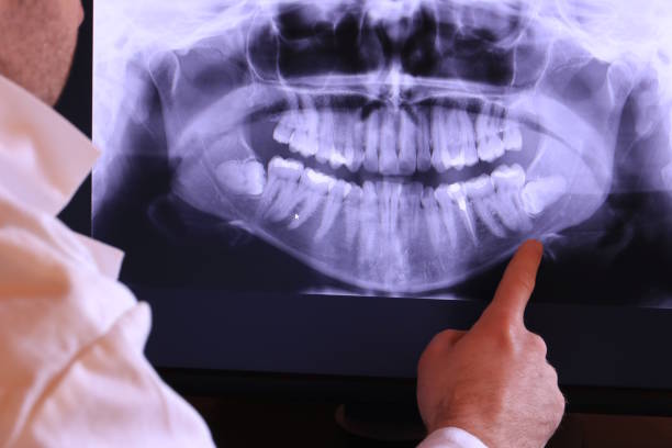 Best Emergency Broken Tooth Repair in Tazewell, VA