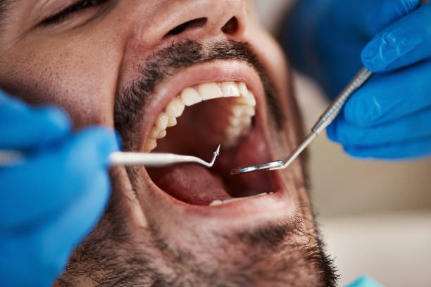 Best Same-Day Emergency Dentist in Tazewell, VA