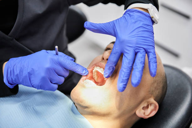 Best Emergency Treatment for Toothache in Tazewell, VA