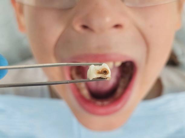 Best Emergency Orthodontic Repairs in Tazewell, VA